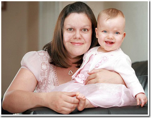 Picture 2 of Premature babies survive by scratching their feet