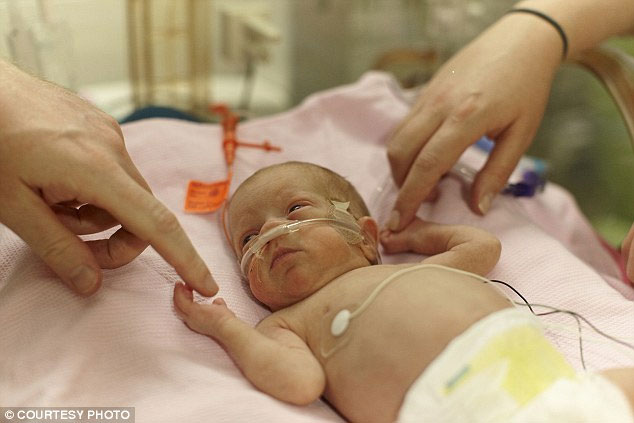 Picture 2 of Premature babies weigh 720g