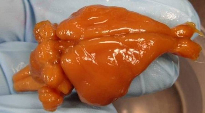 Picture 1 of Preserving the brain perfectly with vitrification