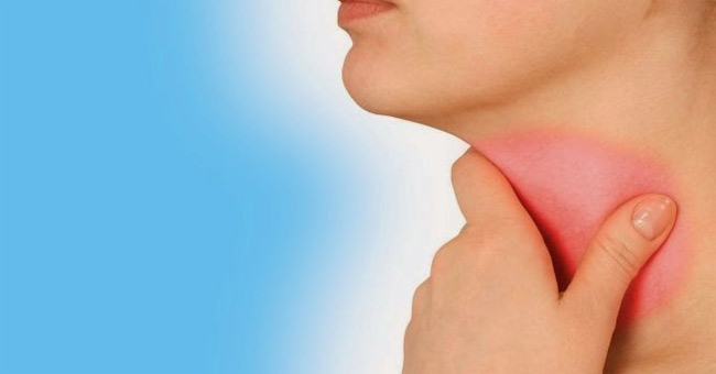 Picture 2 of Preventing and treating acute pharyngitis when the weather changes