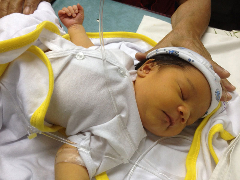 Picture 1 of Preventing jaundice in newborns