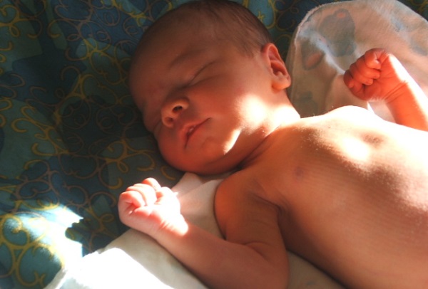 Picture 2 of Preventing jaundice in newborns