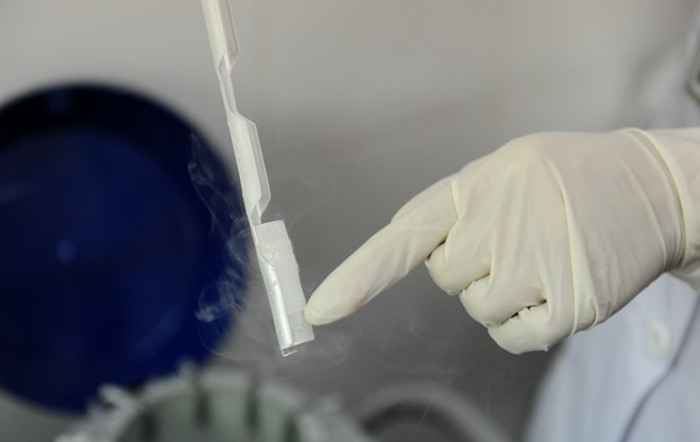 Picture 10 of Process of storing spermatozoa at Hanoi Obstetrics Hospital