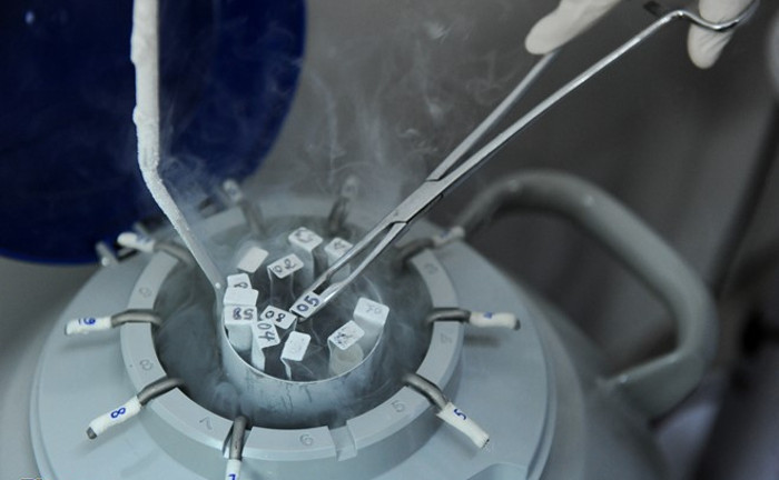 Picture 8 of Process of storing spermatozoa at Hanoi Obstetrics Hospital