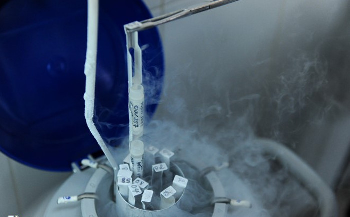 Picture 9 of Process of storing spermatozoa at Hanoi Obstetrics Hospital