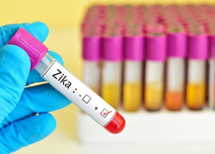 Picture 2 of Process of Zika virus testing in Vietnam