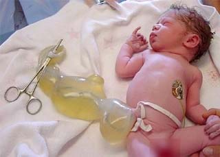 Picture 2 of Producing insulin from stem cells to treat diabetes