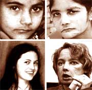 Picture 1 of Psychological impact of face transplant surgeries