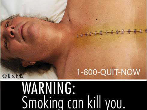 Picture 2 of Published 9 pictures illustrating the harmful effects of tobacco