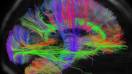 Picture 1 of Published a map of human brain