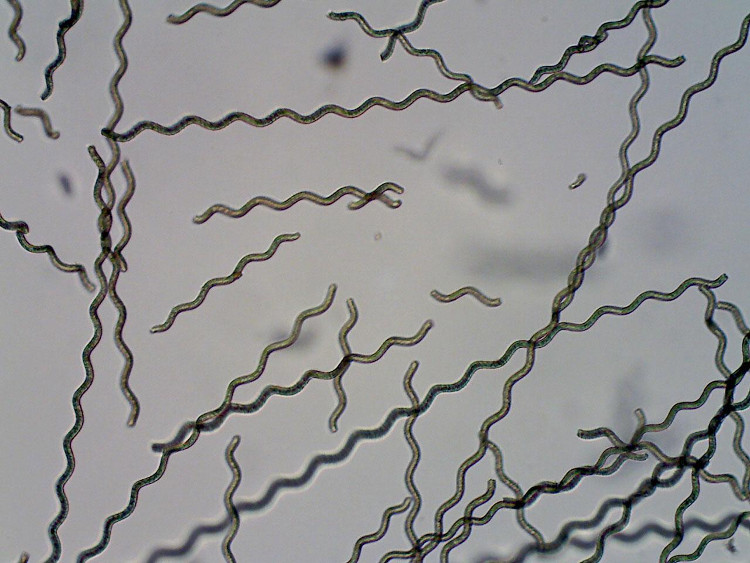 Picture 1 of Put the micro algae robots into the body to spy on and treat cancer