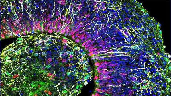 Picture 1 of Raising an artificial 6-month-old brain, for the first time, a baby-like brain wave is emitted