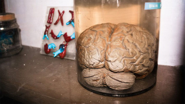 Picture 2 of Raising an artificial 6-month-old brain, for the first time, a baby-like brain wave is emitted