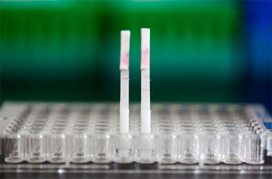 Picture 1 of Rapid detection of cancer with test strips