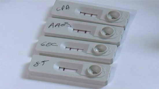 Picture 1 of Rapid test equipment for leprosy