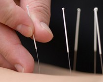 Picture 1 of Reduce eczema with tea and acupuncture