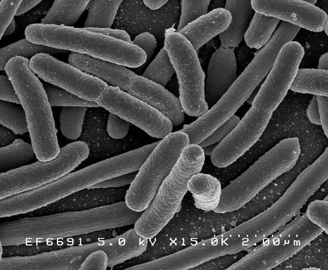 Picture 2 of 'Reprogramming' E.Coli bacteria to fight ... cancer