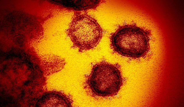 Picture 2 of Research: Corona virus may have been transmitted to humans for decades