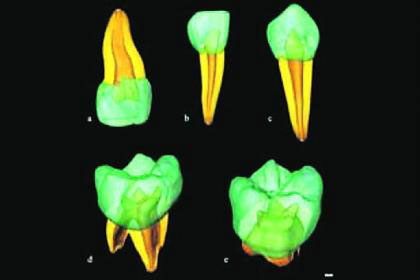 Picture 1 of Research evolved through teeth 30,000 years ago