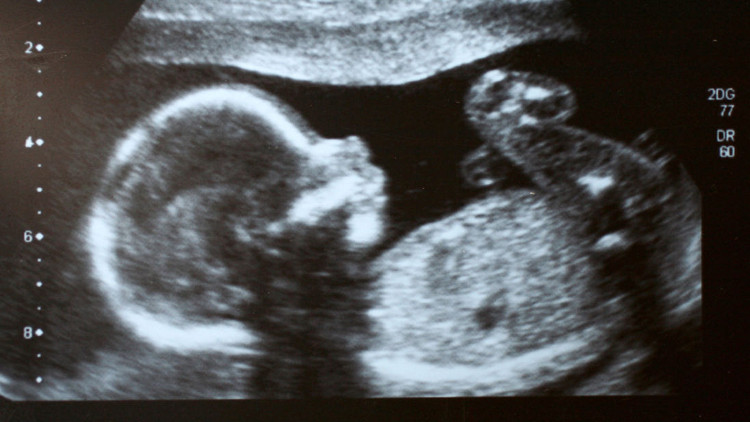 Picture 1 of Research found vitamin B3 helps reduce miscarriage, birth defects
