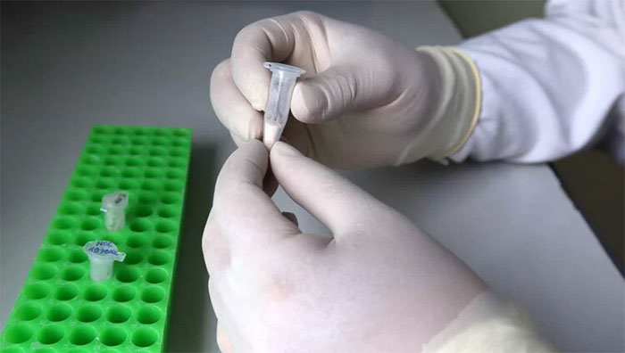 Picture 1 of Research on the Vietnamese genome found many rare diseases