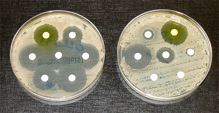 Picture 3 of Resistant bacteria can spread through the air, and this is not good news