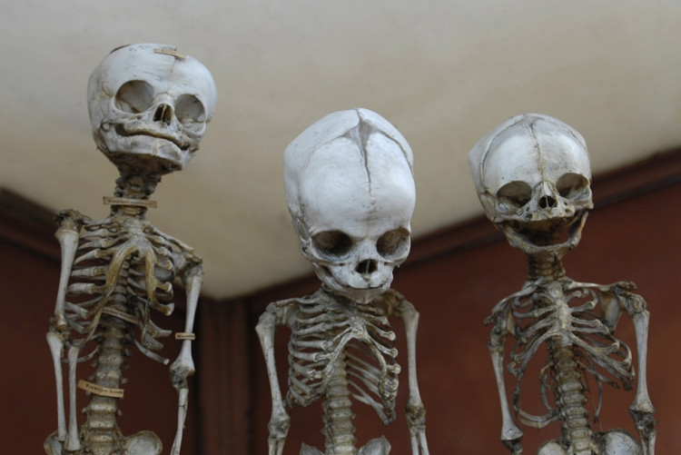 Picture 3 of Reveal about 6 cases of using the body of a donor