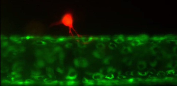 Picture 2 of Reveal how cancer cells metastasize in the human body