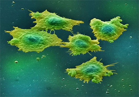 Picture 1 of Reverse effects of chemotherapy and radiation therapy