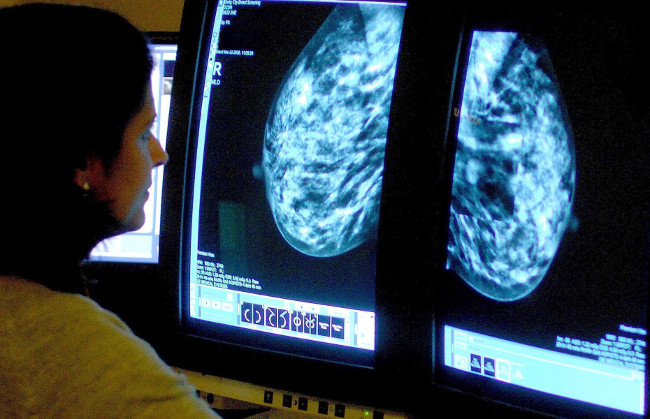 Picture 2 of Rise early 1 year, cancer risk increased by at least 6%