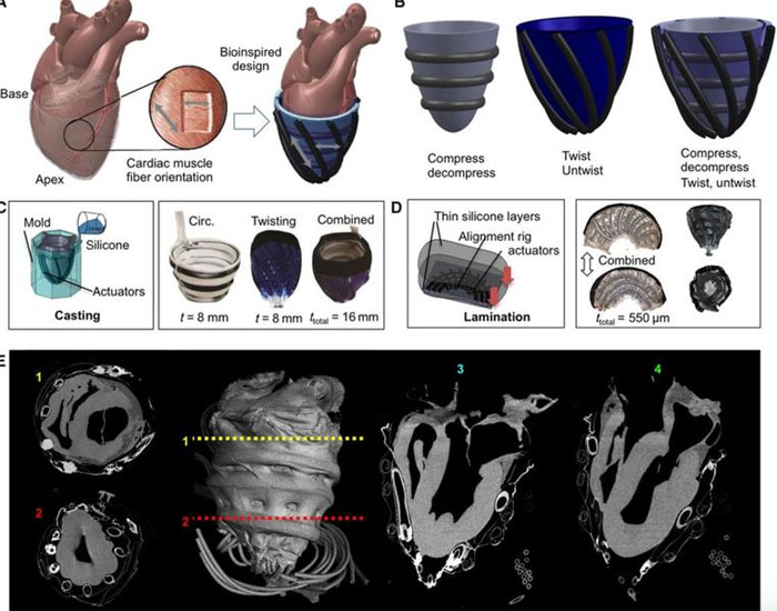 Picture 2 of Robots help patients with heart failure through critical attacks