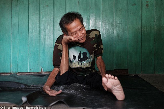 Picture 10 of 'Rubber people' have the ability to drink plastic like snakes