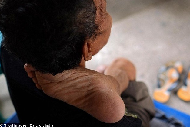 Picture 9 of 'Rubber people' have the ability to drink plastic like snakes