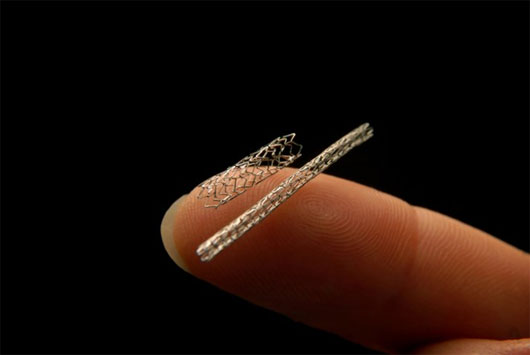 Picture 1 of Russia successfully built a more optimized stent