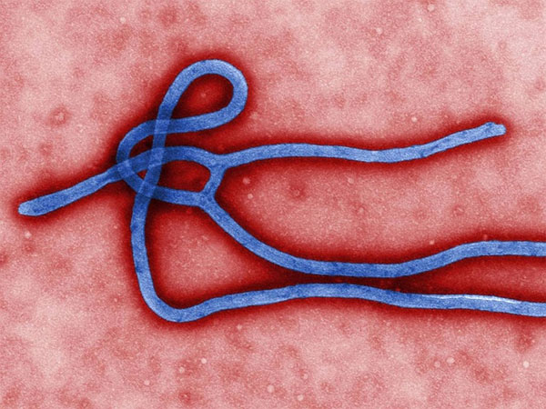 Picture 1 of Russia warned of the risk of Ebola as a biological weapon