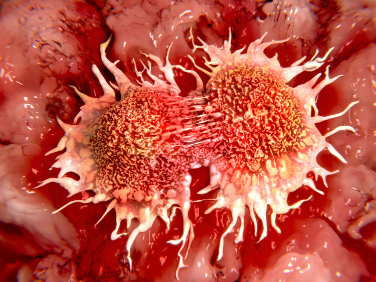 Picture 1 of Russian and Swedish scientists have found a way to kill cancer cells