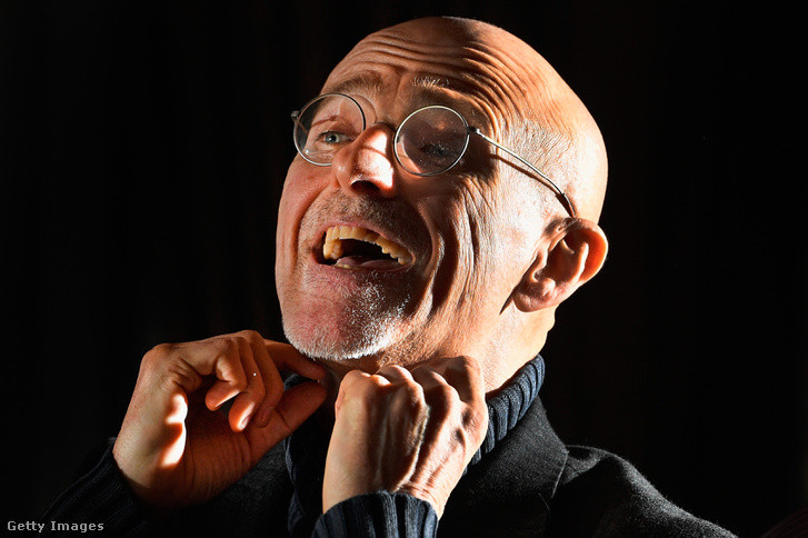 Picture 3 of Russian patients turn off hope for a head transplant surgery