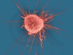 Picture 1 of Save eggs for childbirth after cancer treatment