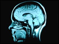 Picture 1 of Scan shows how future brain sketches