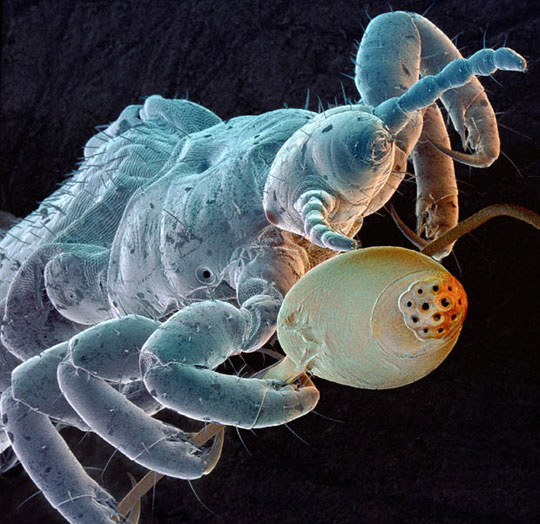 Picture 1 of Scanning 'tiny monsters' through a microscope