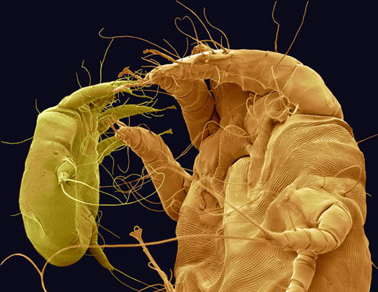 Picture 8 of Scanning 'tiny monsters' through a microscope
