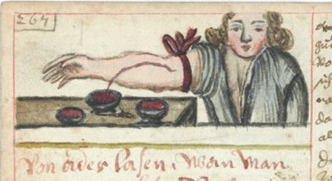 Picture 4 of Scary healing ways in the Middle Ages