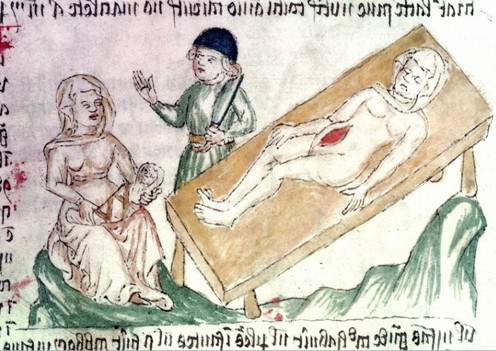 Picture 5 of Scary healing ways in the Middle Ages