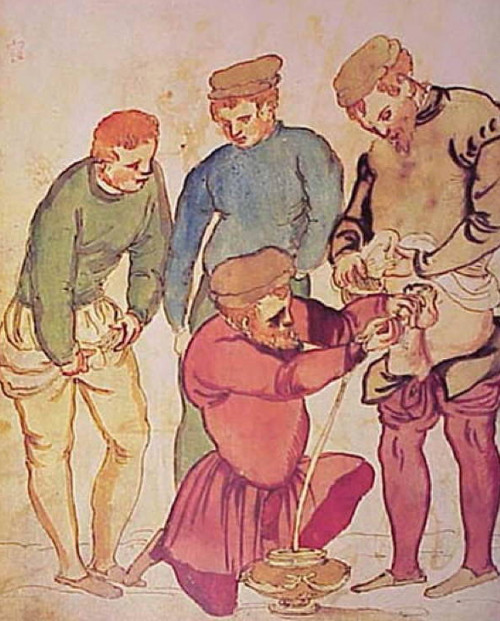 Picture 6 of Scary healing ways in the Middle Ages