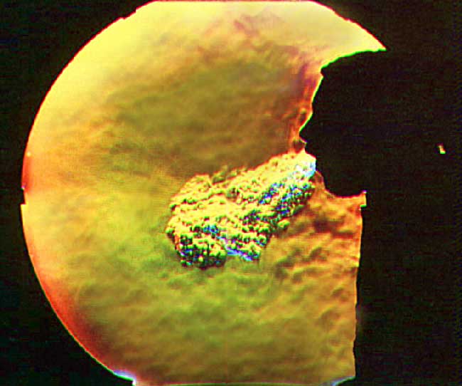 Picture 1 of Science of coughing and sneezing