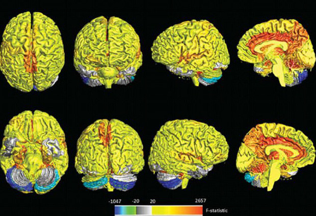 Picture 2 of Science proves: Women really tend to do too much
