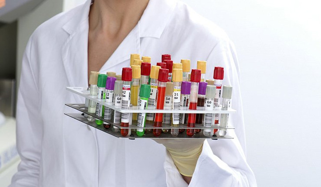 Picture 2 of Science says: Just getting the DNA code will give you the perfect weight loss mode!