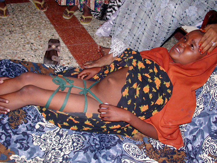 Picture 3 of Scientific explanation for painful customs with girls in Africa