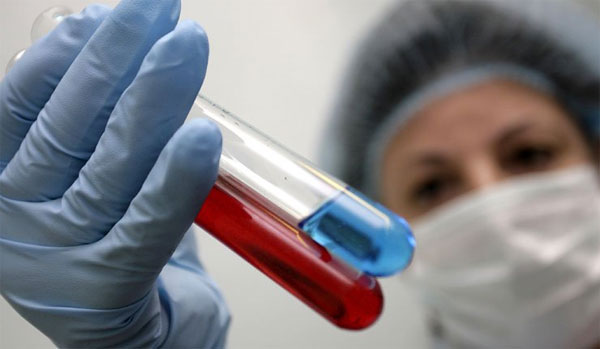 Picture 1 of Scientists developed methods for rapid testing of influenza viruses