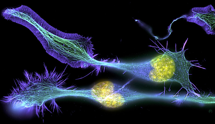 Picture 1 of Scientists discover that the old brain always produces new cells